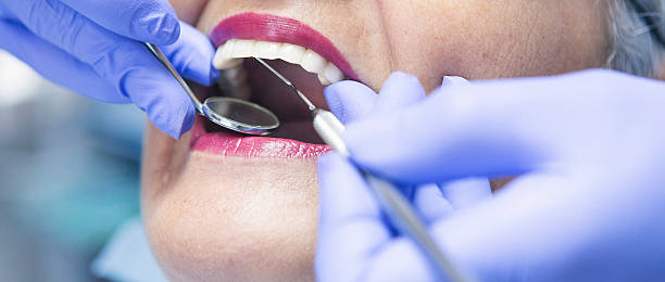 Best Chipped Tooth Repair Near Me  in Good Hope, CA